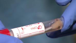 Covid-19 patients in hospital remain at same level 