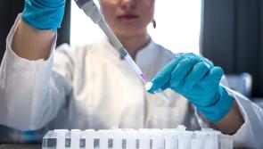 'Always better to be prepared' - Irish Monkeypox team formed
