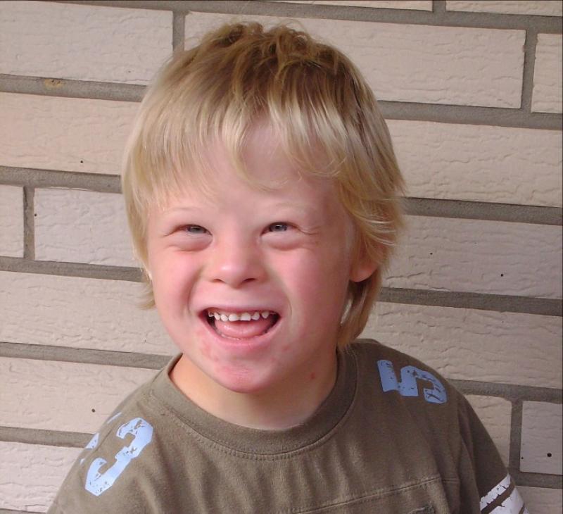 iddt51 little boy with down syndrome