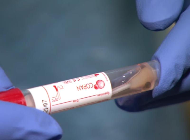 Covid-19 patients in hospital remain at same level 