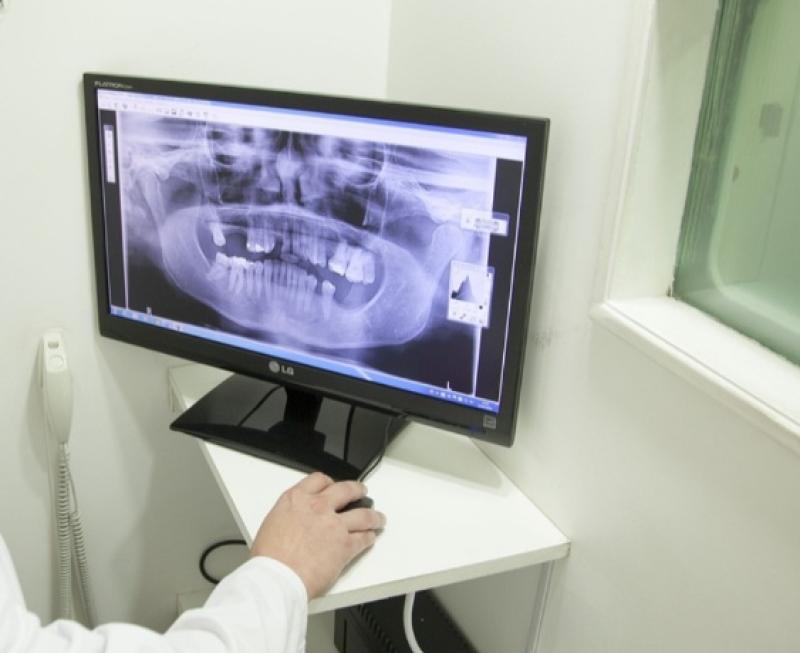 Fears for patients due to backlog of x-ray readings at Louth hospital