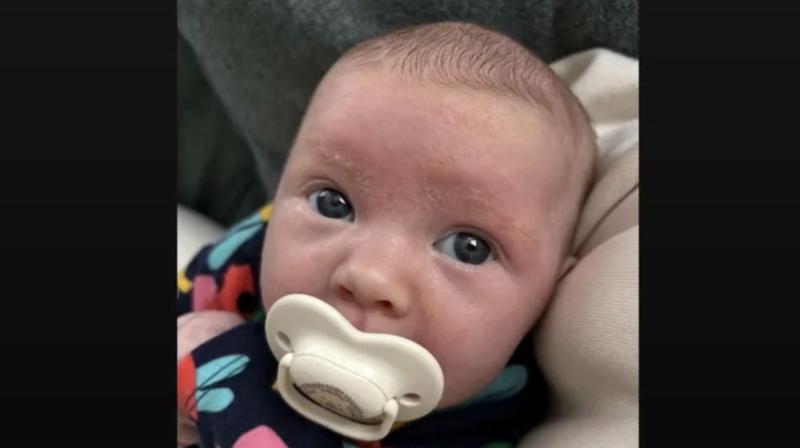 'Our beautiful miracle baby'-  Go Fund Me raised over &euro;31K for baby girl 